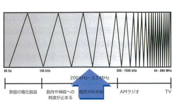 電気外科手術スタディガイド 図2
