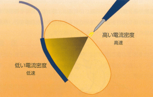 電気外科手術スタディガイド 図5